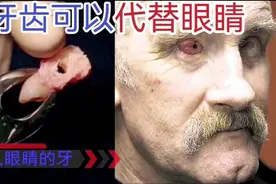 真实手术牙齿植入眼睛可以恢复视力。视频封面