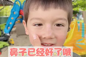 谢谢阿姨和姐姐们的关心，我鼻子已经好了哦视频封面