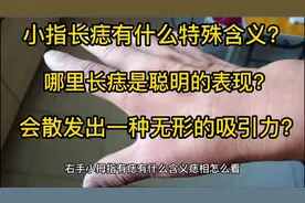 右手小拇指有痣有什么含义，痣相怎么看，会影响命运吗？视频封面
