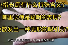 右手小拇指有痣有什么含义，痣相怎么看，会影响命运吗？视频封面