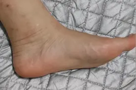 太溪穴视频封面