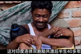 印度连体双胞胎共度后半生40年，嫁给了一个男人，婚后生活太心酸视频封面