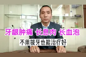 牙龈肿痛、长息肉、长血泡，不用拔牙也能治疗好。视频封面