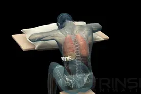 感觉胸闷，可能有胸水，看看胸腔穿刺抽液手术，3D演示。。