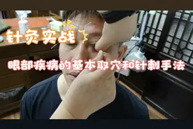 针灸实战：眼部疾病的基本取穴和针刺手法视频封面