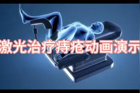 激光治疗痔疮过程动画演示！视频封面