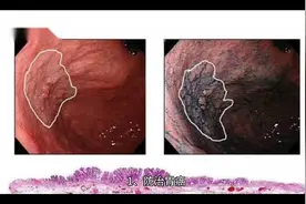 茄子的功效与作用