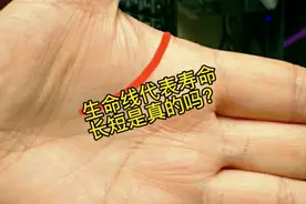 生命线长短代表着寿命吗？视频封面