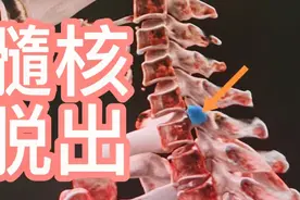 一个68岁大娘买菜回家突然觉得右手没力，刚到医院就被通知手术！视频封面