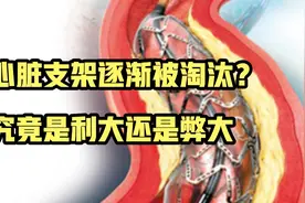 国内将逐渐停止心脏支架手术？支架究竟是利大还是弊大，真相来了视频封面