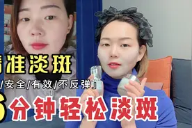 脸上有斑怎么办 40岁宝妈分享每天6分钟安全快速淡斑不反弹视频封面