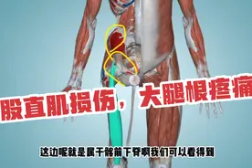 大腿前方根部疼痛，不敢屈曲大腿，膝盖疼，了解一下股直肌视频封面
