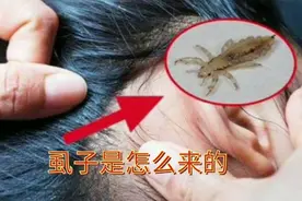 虱子是怎么来的视频封面