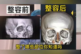 整容前后CT对比，整了哪些地方你知道吗？来猜一猜，评论区见