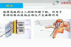 人体局部解剖学-腰穿和腰麻的解剖学基础视频封面