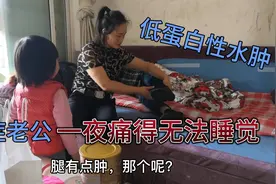 癌症老公刚出院，双脚就开始出现水肿，止痛药只能管一个小时！视频封面