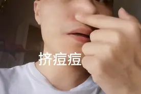 上火！鼻子旁长了颗又红又肿又硬的痘痘！挤出粉和血！疼！没熟透视频封面