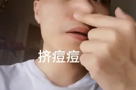 上火！鼻子旁长了颗又红又肿又硬的痘痘！挤出粉和血！疼！没熟透视频封面