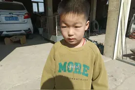 小朋友烧了两天好了的样子，最后我烧了两天后的样子头发都白了呢