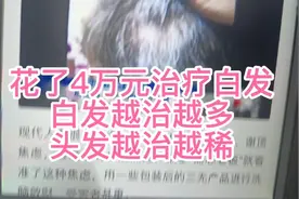 花4万元治疗白发头发越治越白是怎么回事？白转黑打卡160天视频封面