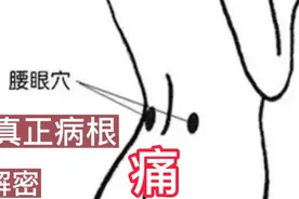 腰眼痛，真正病根位置在这里！曹修行原发点疗法掌门。视频封面