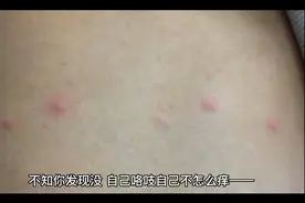 人为什么挠自己就不怕痒？视频封面
