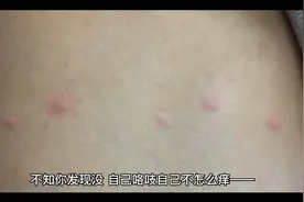 人为什么挠自己就不怕痒？视频封面