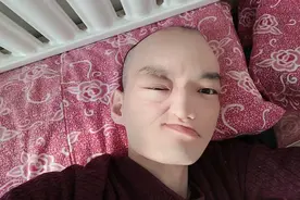 骨癌晚期毁容瘫痪的我，虽然很痛，但依然勇敢微笑面对视频封面