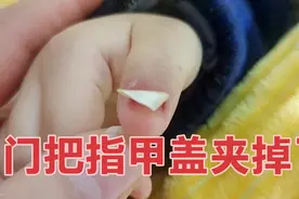 宝爸不小心把宝宝的手给夹了，指甲盖已经脱落，还能长出新的来吗视频封面