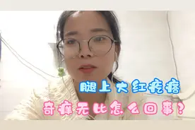 小杰腿上起了好多可大又可痒红疙瘩，这是怎么回事？对什么过敏呢
