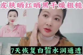 皮肤晒红晒黑干燥粗糙，用这妙招7天恢复白皙水润通透，效果超赞视频封面