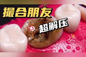 超解压！换牙全过程！看完整个人都舒畅了~视频封面