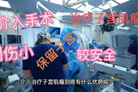 介入治疗子宫肌瘤的优势视频封面
