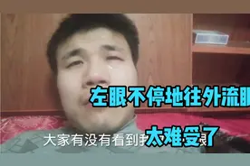 小伙不小心被硬物戳伤了左眼,不停的往外流眼泪，太难受了