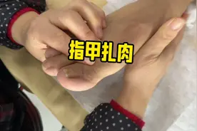 老师傅指甲扎肉了，他自己说这脚都修了几十年了。视频封面