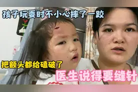 孩子玩耍时不小心把额头给磕破了，医生说得要缝针！把小韩吓到了视频封面