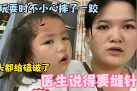 孩子玩耍时不小心把额头给磕破了，医生说得要缝针！把小韩吓到了视频封面