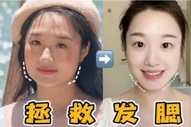 发腮对颜值影响有多大？发腮自救指南视频封面