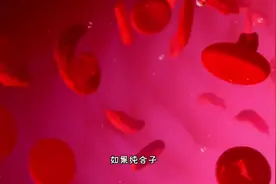 世界上第一个基因病 镰状细胞贫血，3D演示。。视频封面