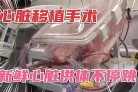 心脏移植手术怎么做？直观感受 心脏供体完全不停止跳动！新科技视频封面