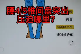 腰4/5椎间盘突出压迫神经什么表现呢？视频封面