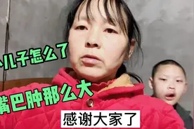 俩脑瘫儿真叫妈妈担心，小儿子睡一觉醒嘴为啥肿那么高是怎么回事视频封面