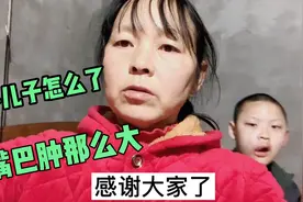 俩脑瘫儿真叫妈妈担心，小儿子睡一觉醒嘴为啥肿那么高是怎么回事视频封面