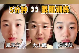 5分钟眼肌训练👀大眼操，眼睑肌无力👋视频封面