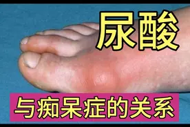 尿酸过低还会增加痴呆症风险？教您如何控制尿酸视频封面