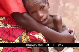 23岁了还像个婴儿。需要父母抱着生活医生都束手无策视频封面