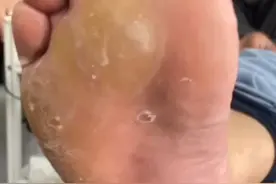 解压，死皮去除，修脚，放松