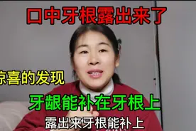牙龈盖不住牙根了，没想到，医学发达牙龈也能给补上了@西瓜视频视频封面
