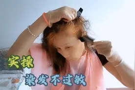 用此方染发一年，摆脱过敏，脸部不再红肿，从此不再用化学染发剂视频封面