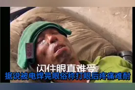 防止电焊打眼，电焊打眼有效的缓解方法，有你意想不到的收获视频封面